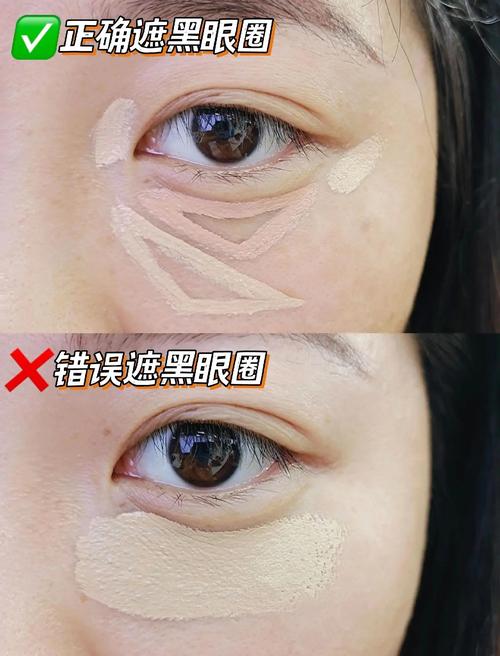 什么去黑眼圈效果好