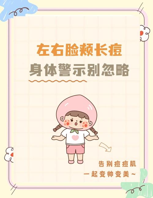 右脸长痘痘为什么