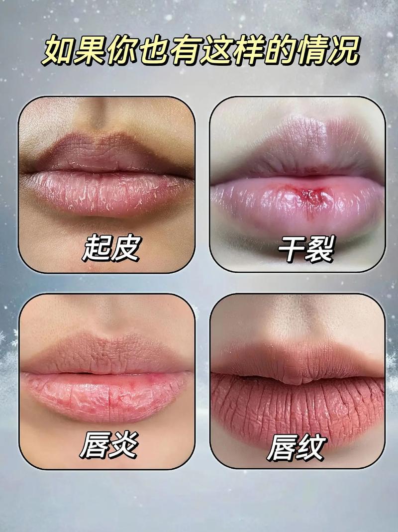 嘴巴很干是什么原因