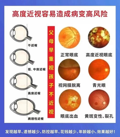 近视眼有什么危害