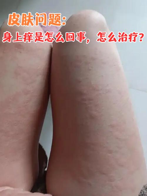 人身上为什么会痒