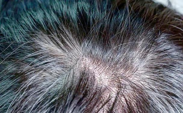 为什么头发有味道