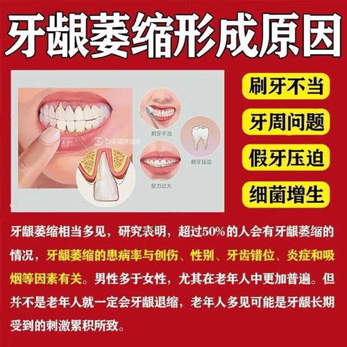 牙周炎用什么药好