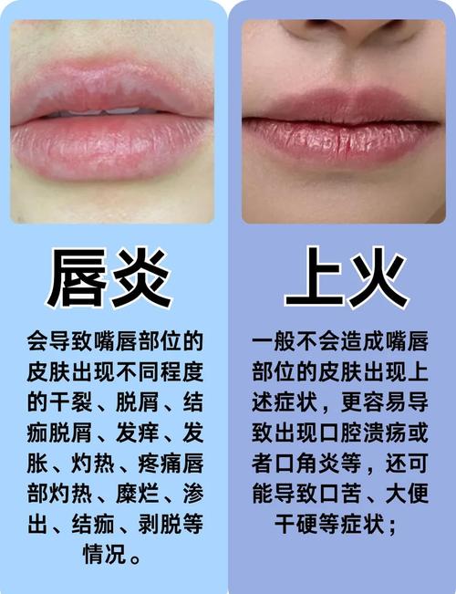 嘴唇发青是什么原因