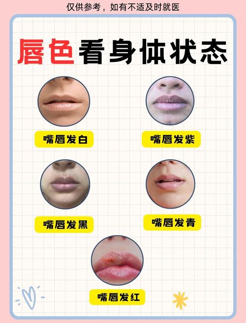 嘴唇发青是什么原因