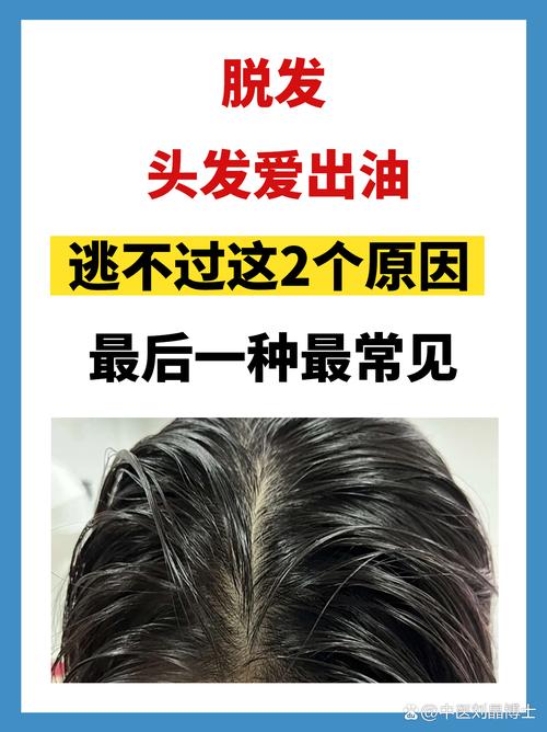 头发很油是什么原因