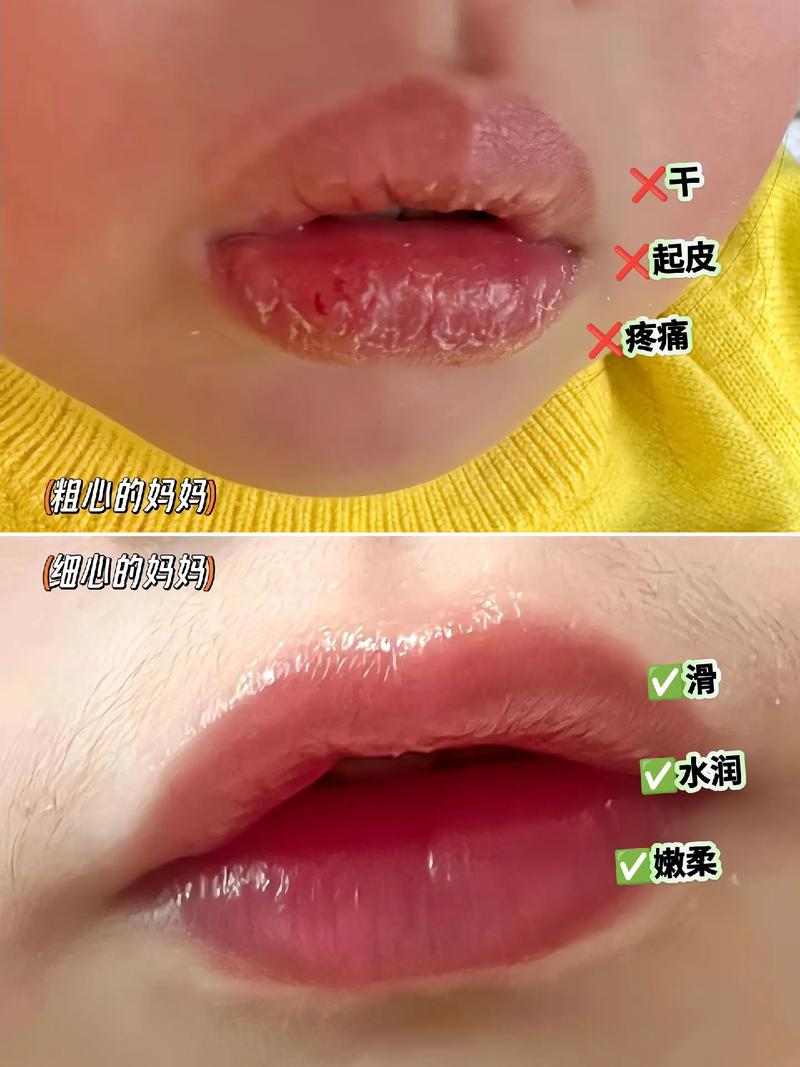 嘴唇脱皮吃什么好