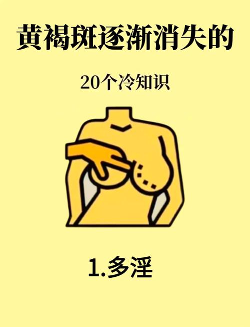 什么去色斑
