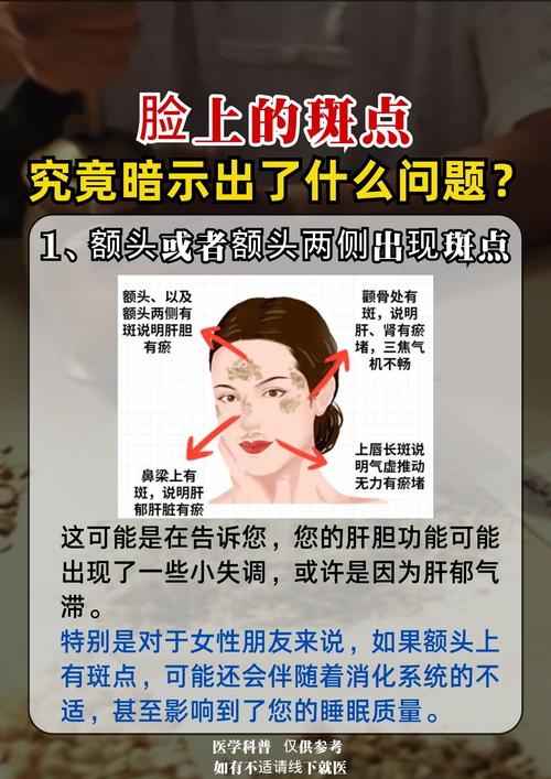 额头长斑是什么原因