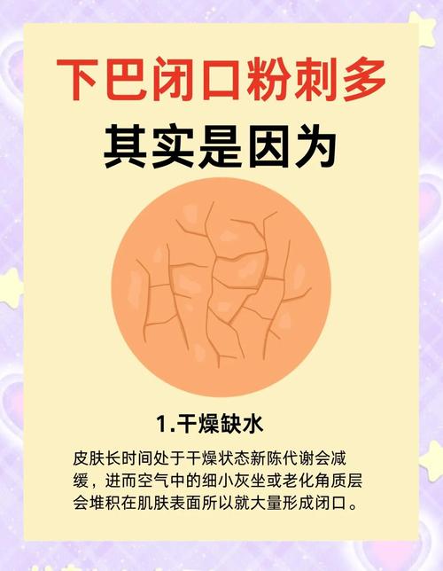 有粉刺是什么原因