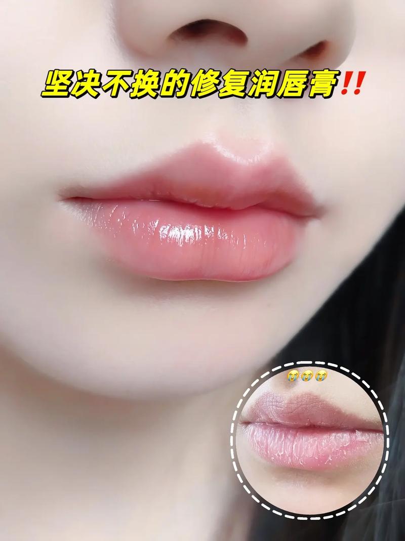 嘴唇干裂用什么唇膏