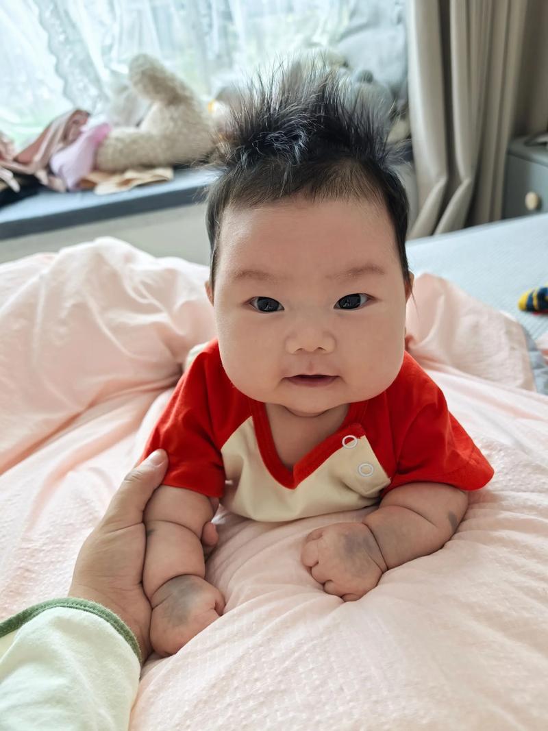 为什么小孩有胎记