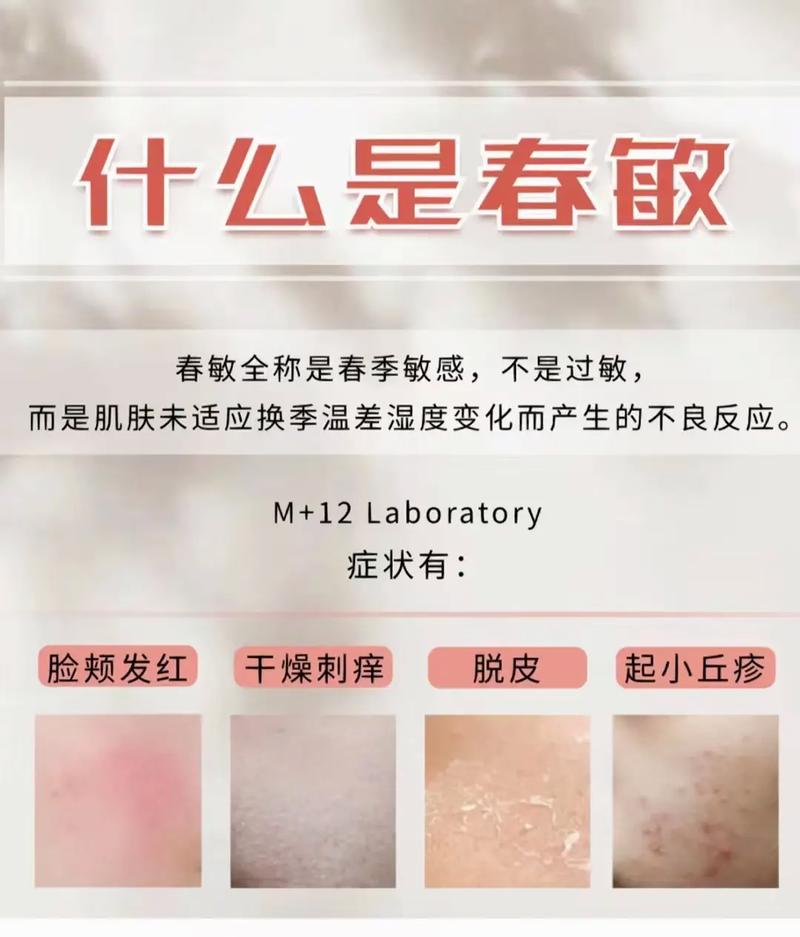 什么季节容易过敏