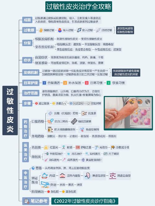 什么季节容易过敏