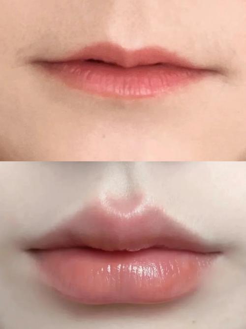 什么是薄嘴唇