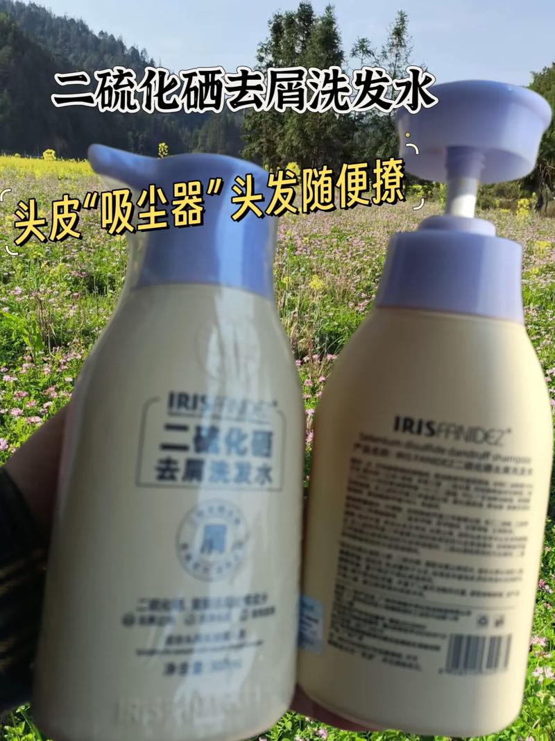 头痒用什么洗发水好