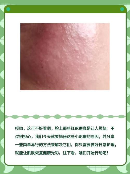 脸上过敏是什么原因