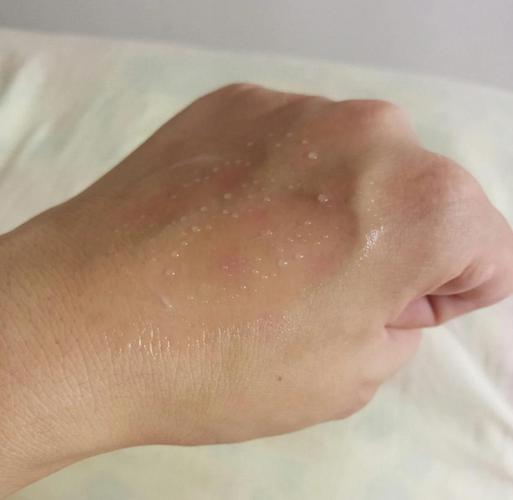 美迪惠尔面膜最新版