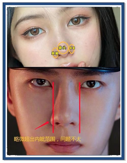 为什么鼻翼会变大