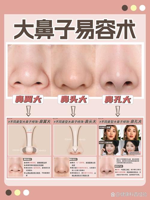 为什么鼻翼会变大