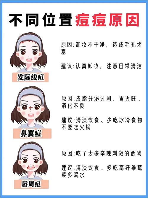 脸上为什么总长痘