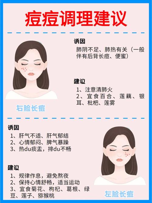 为什么脸上总长痘