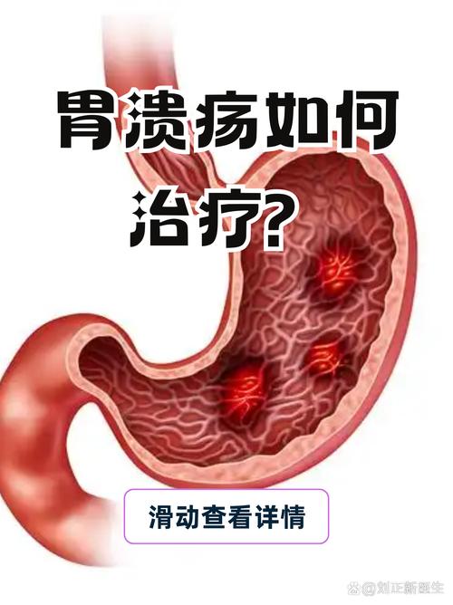 胃病为什么难治