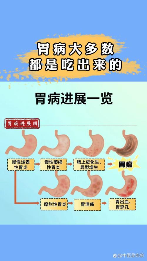 胃病为什么难治