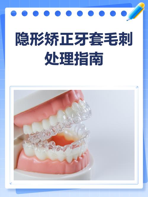 什么是隐形矫正