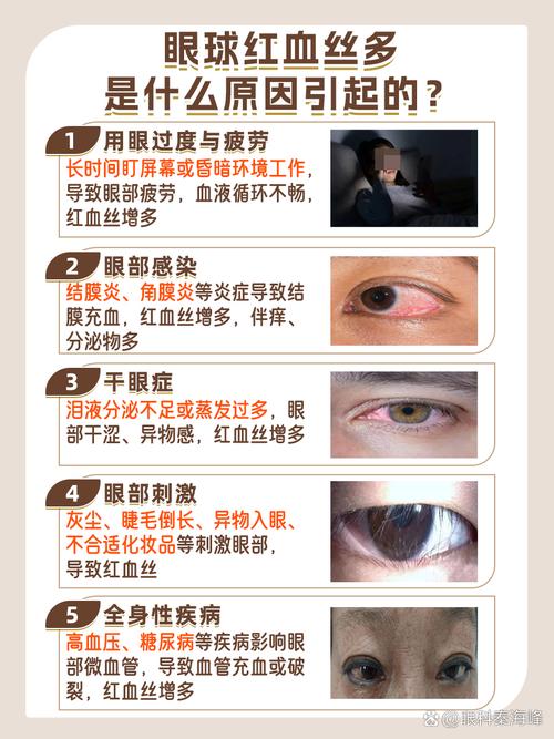 为什么会长红血丝