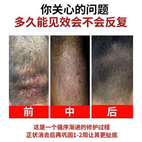 什么洗发水治脱发