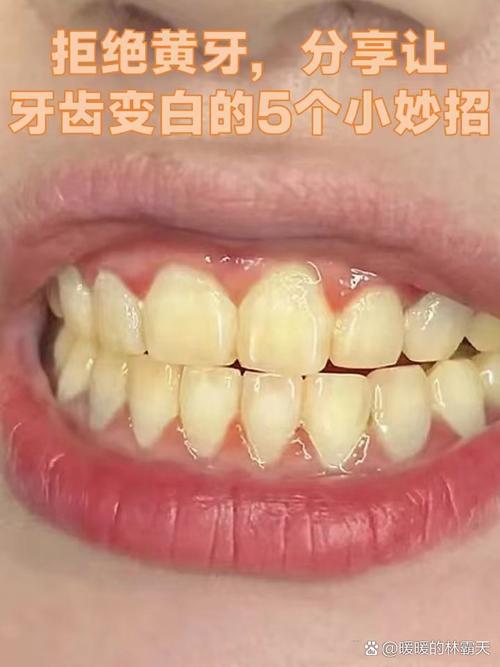 吃什么牙齿会变白