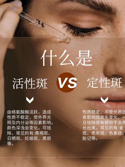 为什么会有色斑