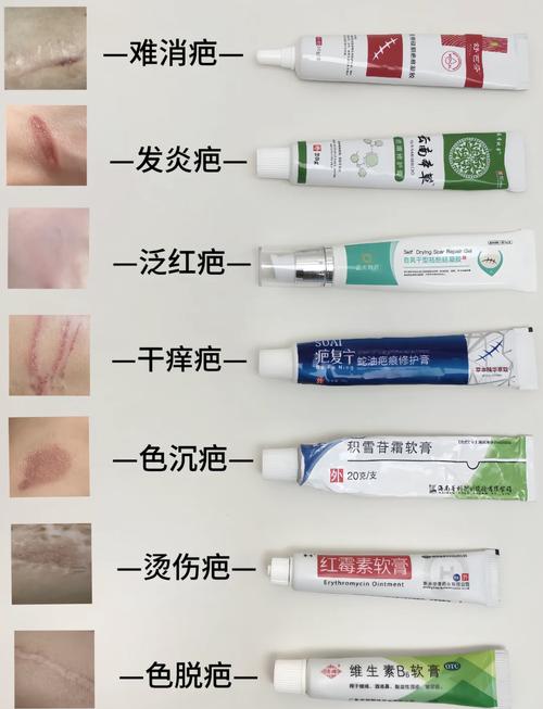 去疤什么好