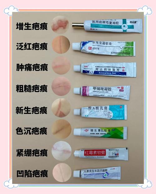 去疤什么好