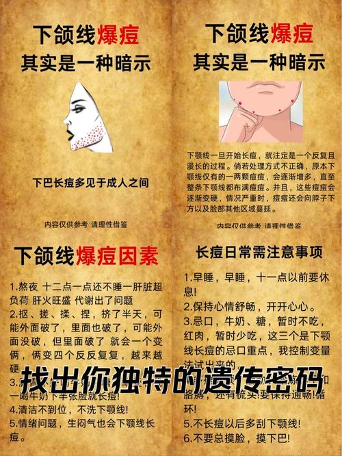 下颚长痘是什么原因