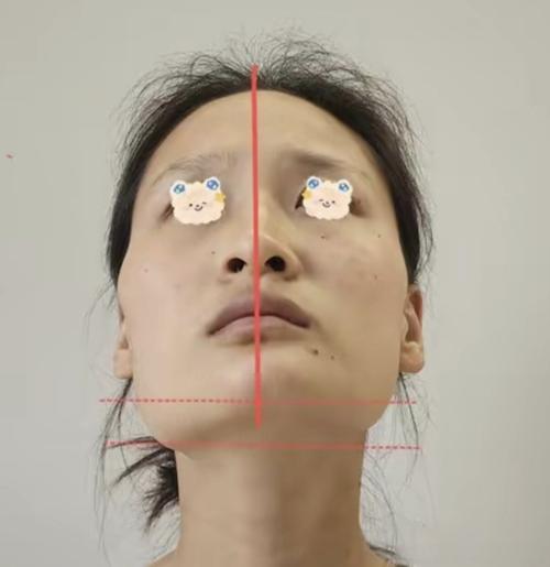 为什么脸型不对称