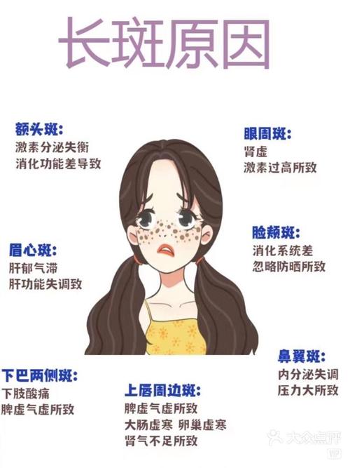 脸上为什么会长斑点
