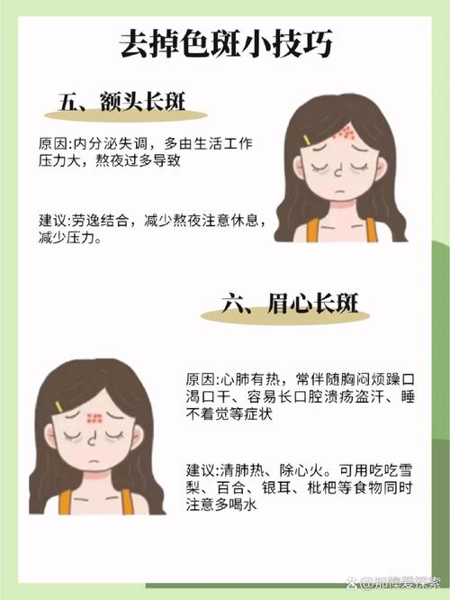 脸上为什么会长斑点