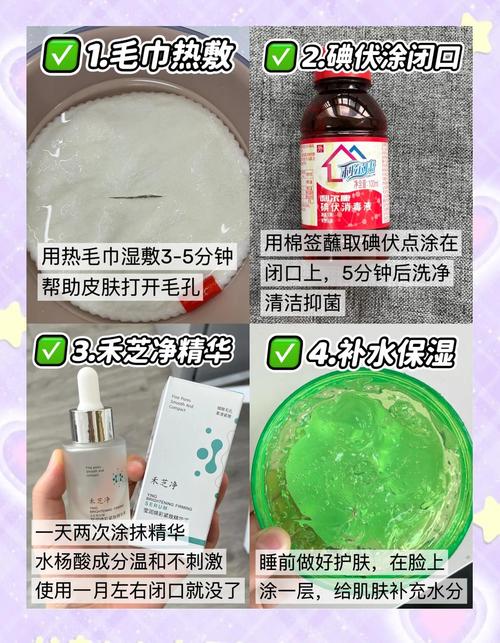 为什么总起痘痘