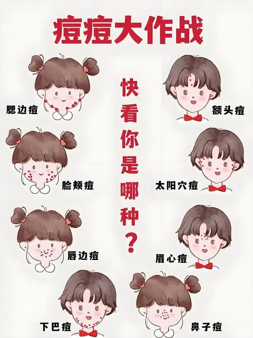 为什么总起痘痘