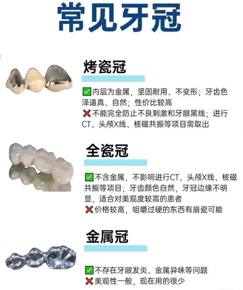 牙科为什么那么贵