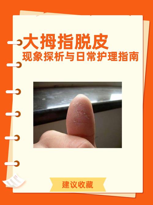 手指头为什么会脱皮