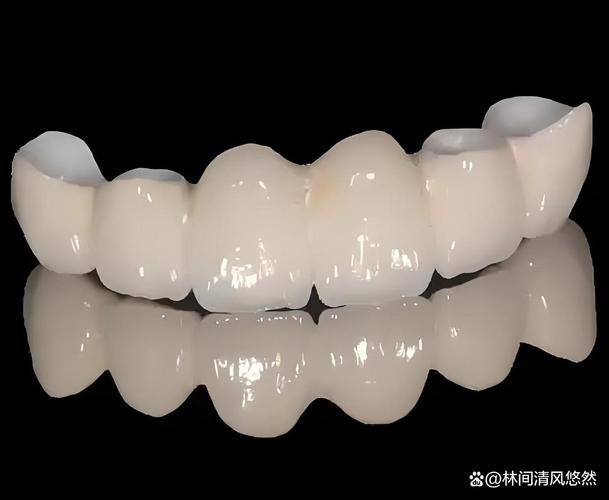 镶牙什么样的好