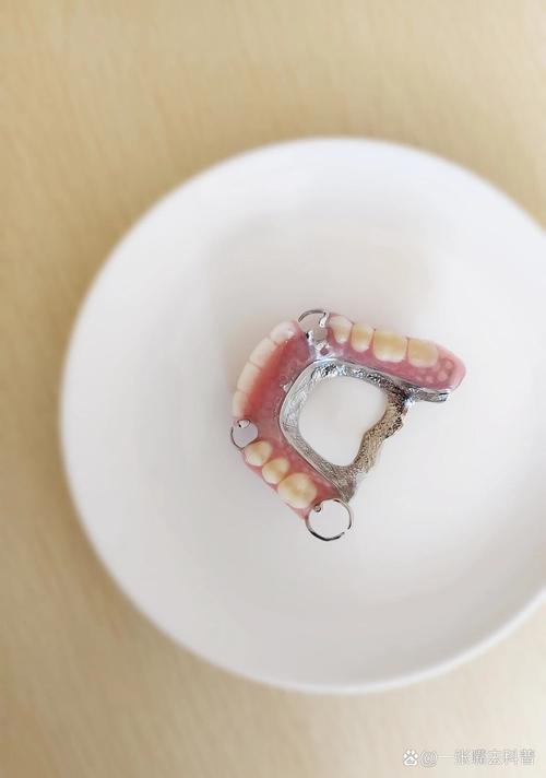 镶牙什么样的好