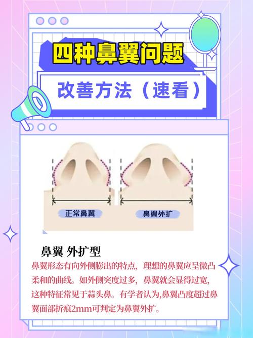 鼻翼为什么会变大