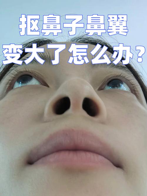鼻翼为什么会变大