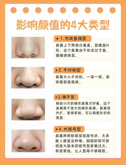 鼻翼为什么会变大