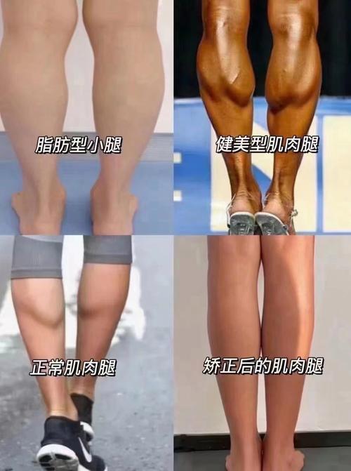 小腿为什么那么粗