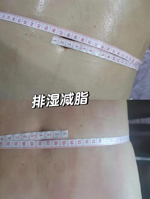 减肥排水做完第二步是什么